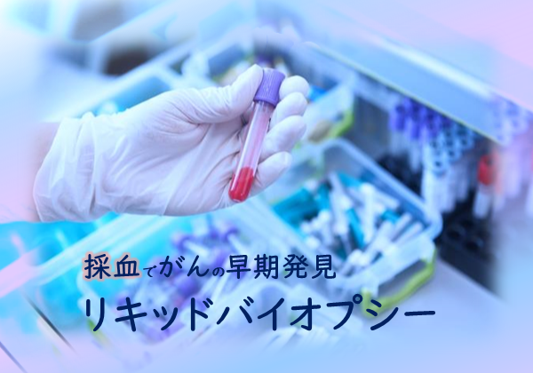 リキッドバイオプシー