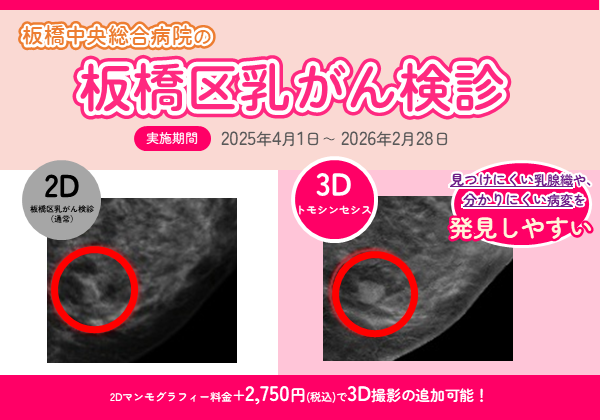 板橋区乳がん検診