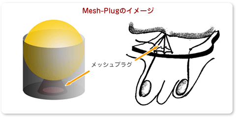 Mesh-Plugのイメージ