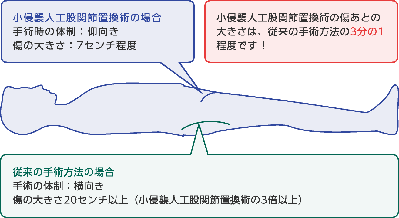 傷あとの小さな手術